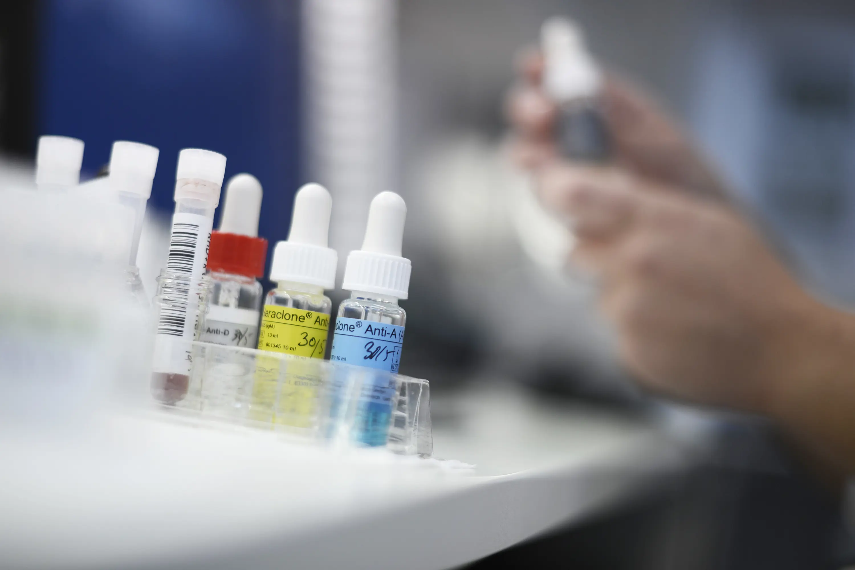 Blood samples an medication, work in the lab. Photo.